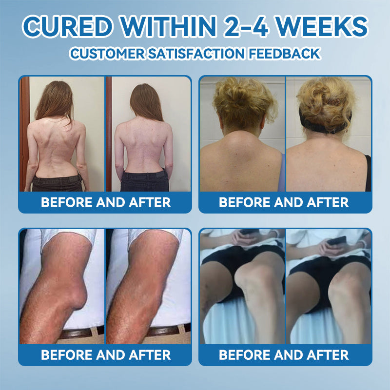 【𝐅𝐢𝐧𝐚𝐥 𝐃𝐚𝐲 – 𝟕𝟎% 𝐎𝐅𝐅】💙 Tnnedey® BPC-157 Joint Healing Cream🦴Treats Arthritis, Neuropathy, Rheumatism, Sports Injuries & More💪