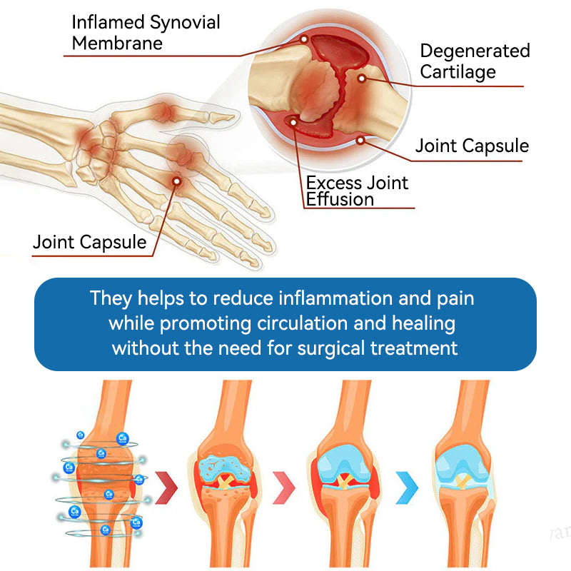 【𝐅𝐢𝐧𝐚𝐥 𝐃𝐚𝐲 – 𝟕𝟎% 𝐎𝐅𝐅】💙 Tnnedey® BPC-157 Joint Healing Cream🦴Treats Arthritis, Neuropathy, Rheumatism, Sports Injuries & More💪