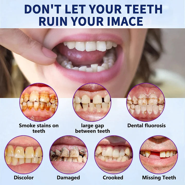 HEATWOLF® - Premium Customized Full Denture Set🦷-The Royal London Dental Hospital accreditation(🍀Limited Time Discount Last 30 Minutes🍀)🍀🍀