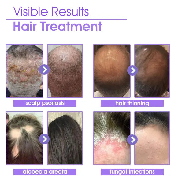DEEVOO® ✨👩🔬 Hair Root Repair Growth Drops – Achieve Thicker Hair Fast⚡