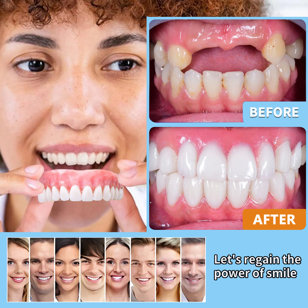 HEATWOLF® - Premium Customized Full Denture Set🦷-The Royal London Dental Hospital accreditation(🍀Limited Time Discount Last 30 Minutes🍀)🍀🍀
