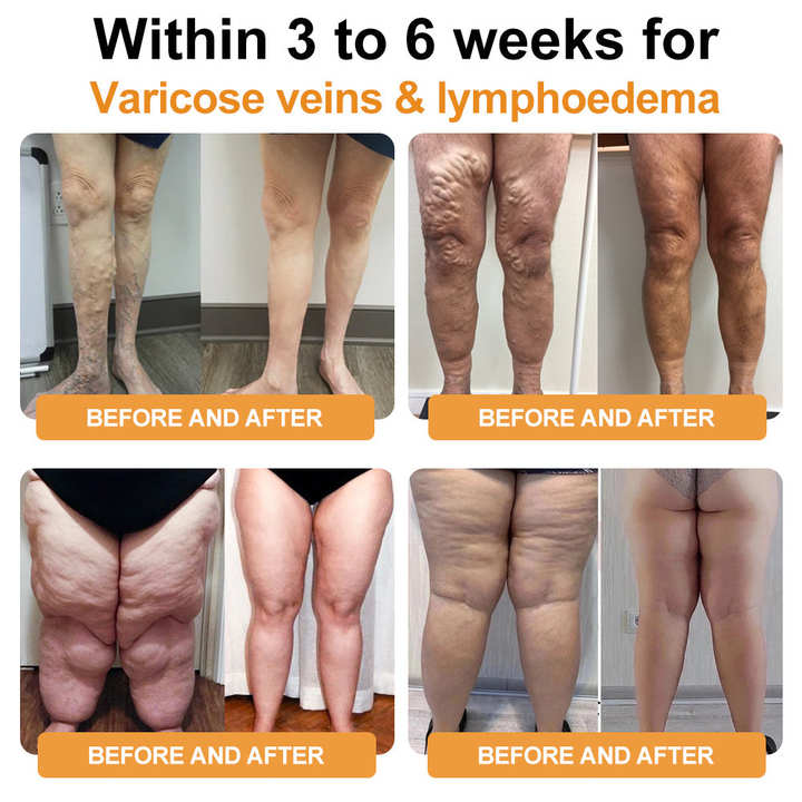 Total Body Wellness Starts Here-Mresio® Ultrasound Fat Reduction & Far Infrared Blood Sugar Balance