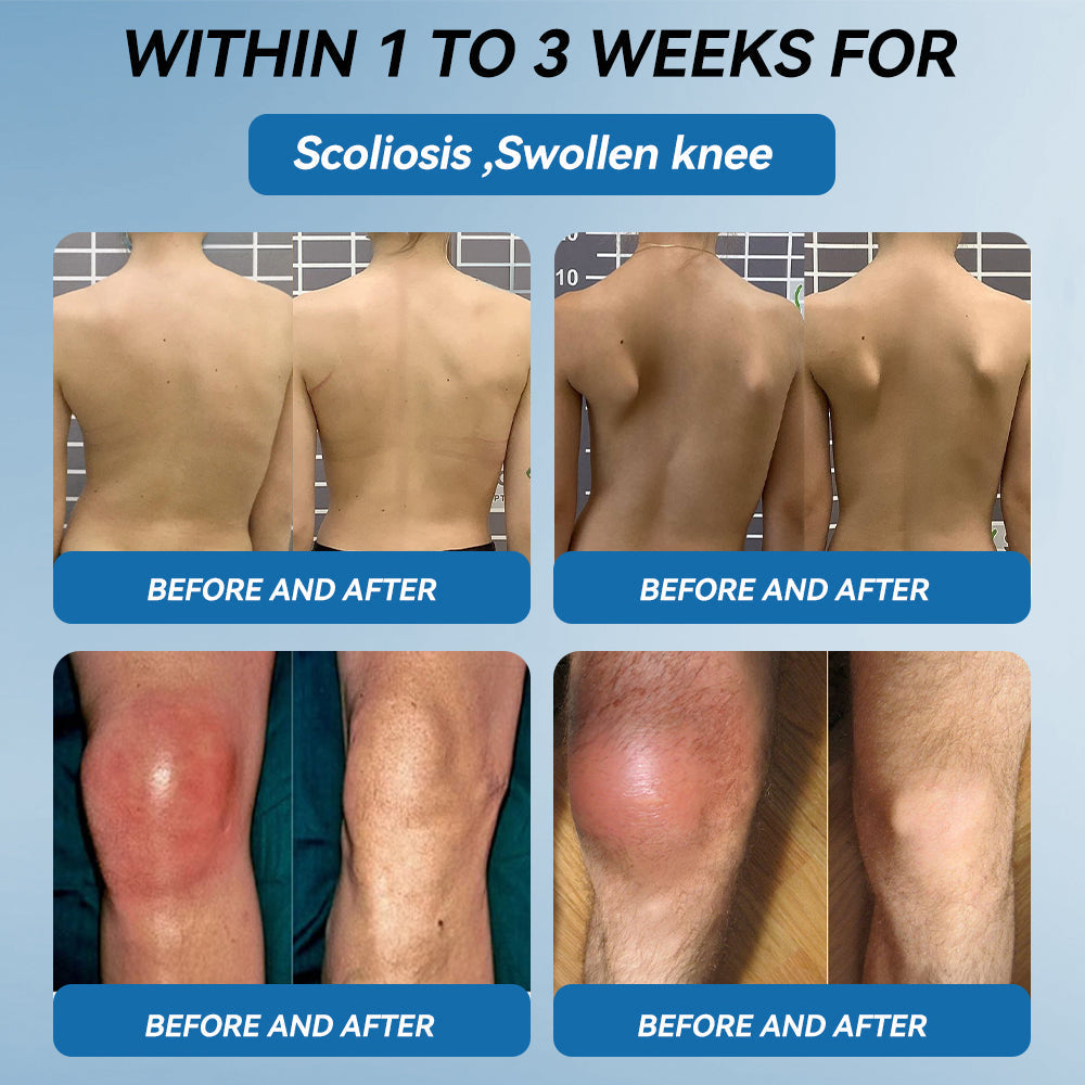 【𝐅𝐢𝐧𝐚𝐥 𝐃𝐚𝐲 – 𝟕𝟎% 𝐎𝐅𝐅】💙 Tnnedey® BPC-157 Joint Healing Cream🦴Treats Arthritis, Neuropathy, Rheumatism, Sports Injuries & More💪