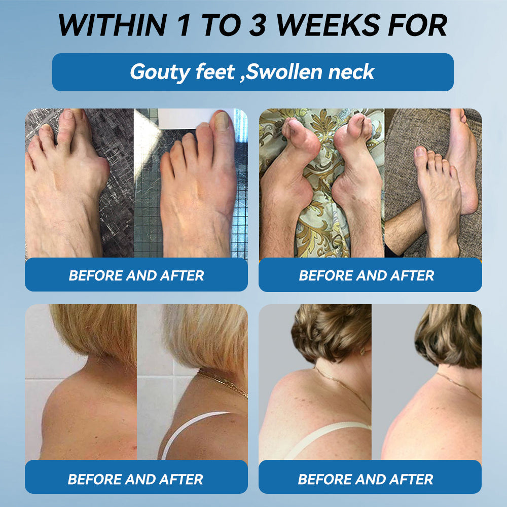 【𝐅𝐢𝐧𝐚𝐥 𝐃𝐚𝐲 – 𝟕𝟎% 𝐎𝐅𝐅】💙 Tnnedey® BPC-157 Joint Healing Cream🦴Treats Arthritis, Neuropathy, Rheumatism, Sports Injuries & More💪