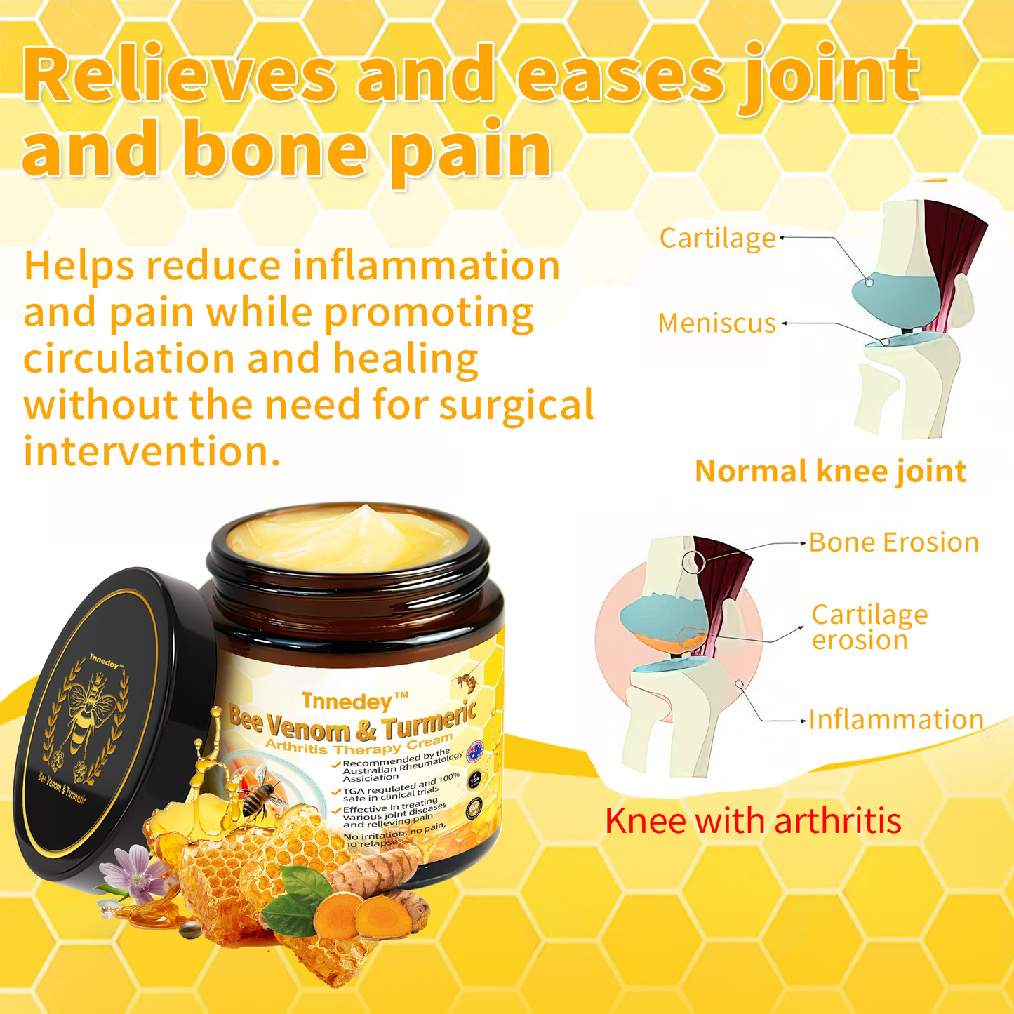 𝐓𝐧𝐧𝐞𝐝𝐞𝐲™ 𝐁𝐞𝐞 𝐕𝐞𝐧𝐨𝐦&𝐓𝐮𝐫𝐦𝐞𝐫𝐢𝐜 𝐀𝐫𝐭𝐡𝐫𝐢𝐭𝐢𝐬 𝐓𝐡𝐞𝐫𝐚𝐩𝐲 𝐂𝐫𝐞𝐚𝐦(👩🔬𝐒𝐩𝐞𝐜𝐢𝐚𝐥𝐢𝐳𝐢𝐧𝐠 𝐢𝐧 𝐨𝐫𝐭𝐡𝐨𝐩𝐞𝐝𝐢𝐜 𝐜𝐨𝐧𝐝𝐢𝐭𝐢𝐨𝐧𝐬 𝐚𝐧𝐝 𝐣𝐨𝐢𝐧𝐭 𝐩𝐚𝐢𝐧👩🔬