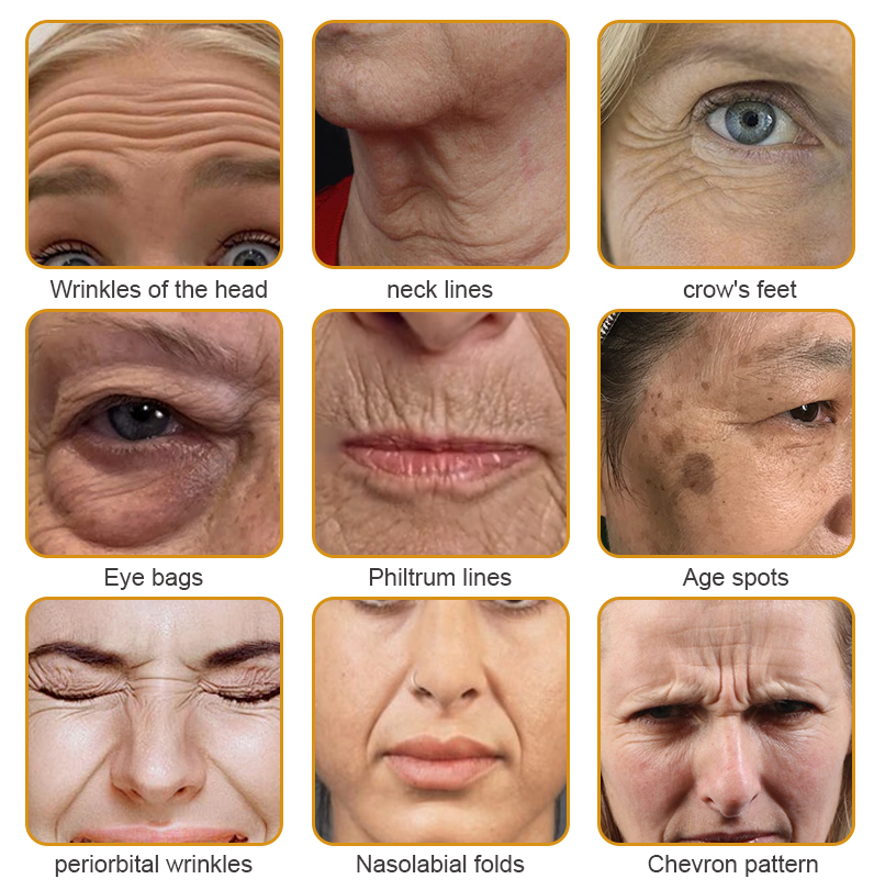 Made and Shipped from the USA✅ Furzero™ Botox Bee Venom Wrinkle Removal Cream-Last Day Promotion 70% OFF