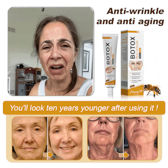 Feel the Difference in Just ONE Use – 70% OFF Today! 💥 Made & Shipped from the UK Fubsta™ Botox Bee Venom Wrinkle Removal Cream – Lifts, Firms & Rejuvenates ✨💆♀️