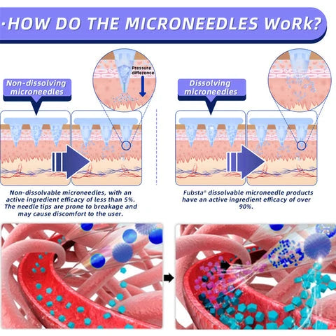 Fubsta™ SMGT-GLP-1 Nano Microneedle Patch 2.0 (✅Painless, long-lasting, addressing diabetes, obesity, and cardiovascular diseases) - 🔥See results in 7 days