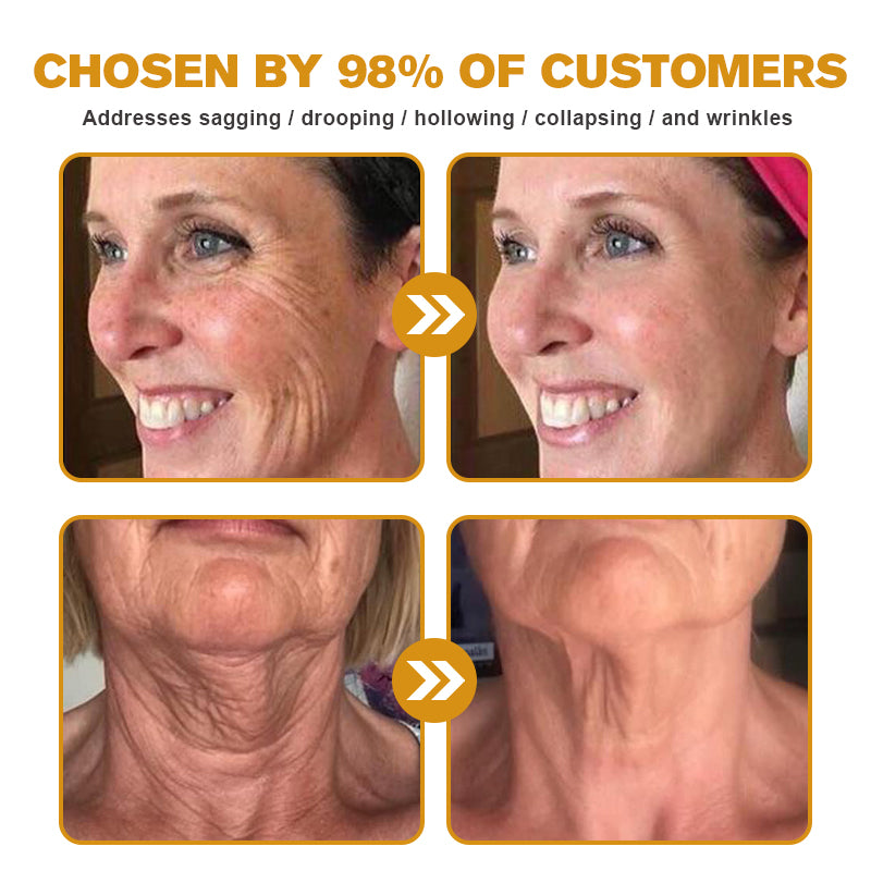 Feel the Difference in Just ONE Use – 70% OFF Today! 💥 Made & Shipped from the UK Fubsta™ Botox Bee Venom Wrinkle Removal Cream – Lifts, Firms & Rejuvenates ✨💆♀️