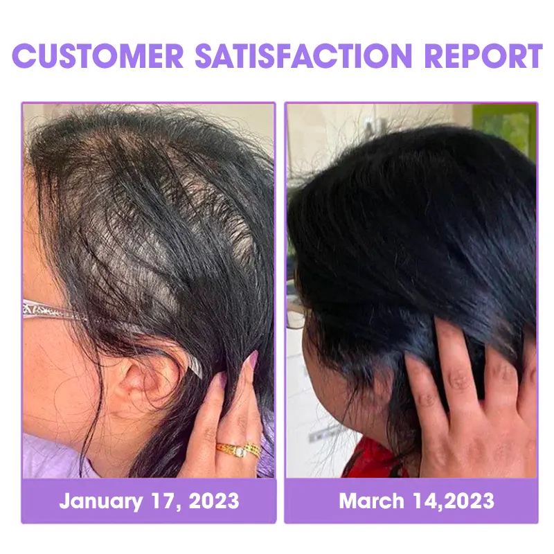 DEEVOO® ✨👩🔬 Hair Root Repair Growth Drops – Achieve Thicker Hair Fast⚡