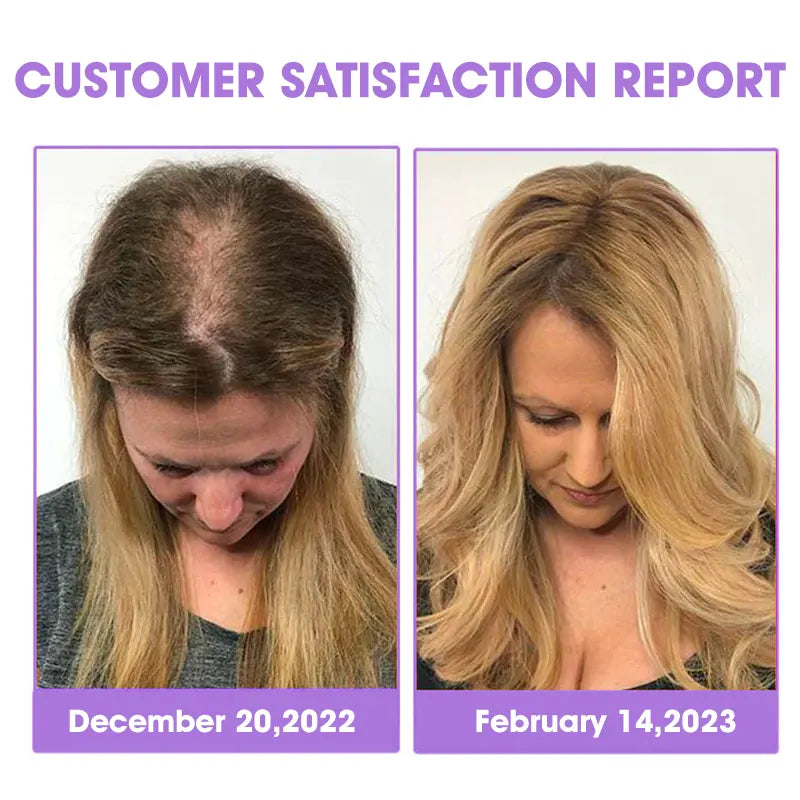 DEEVOO® ✨👩🔬 Hair Root Repair Growth Drops – Achieve Thicker Hair Fast⚡