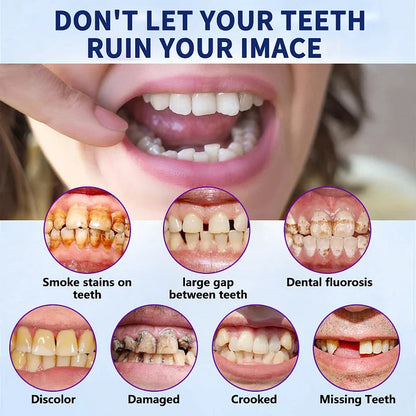 HEATWOLF® - Premium Customized Full Denture Set🦷-The Royal London Dental Hospital accreditation(🍀Limited Time Discount Last 30 Minutes🍀)🍀🍀