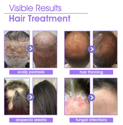 DEEVOO® ✨👩‍🔬 Hair Root Repair Growth Drops – Achieve Thicker Hair Fast⚡