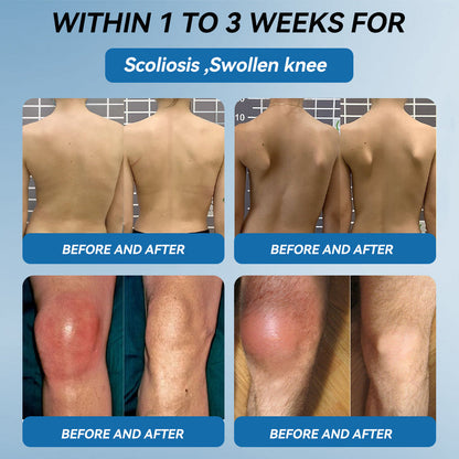 【𝐅𝐢𝐧𝐚𝐥 𝐃𝐚𝐲 – 𝟕𝟎% 𝐎𝐅𝐅】💙 Tnnedey® BPC-157 Joint Healing Cream🦴Treats Arthritis, Neuropathy, Rheumatism, Sports Injuries & More💪