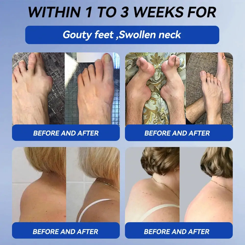| 𝐋𝐚𝐬𝐭 𝐃𝐚𝐲 𝐏𝐫𝐨𝐦𝐨𝐭𝐢𝐨𝐧 𝟖𝟎% 𝐎𝐅𝐅🇬🇧 𝐂𝐫𝐨𝐚𝐢𝐞® 𝐁𝐏𝐂-𝟏𝟓𝟕 𝐉𝐨𝐢𝐧𝐭 𝐇𝐞𝐚𝐥𝐢𝐧𝐠 𝐂𝐫𝐞𝐚𝐦 - 🦴(Treats Arthritis, Neuropathy, Rheumatism, Sports Injuries & More)🏆