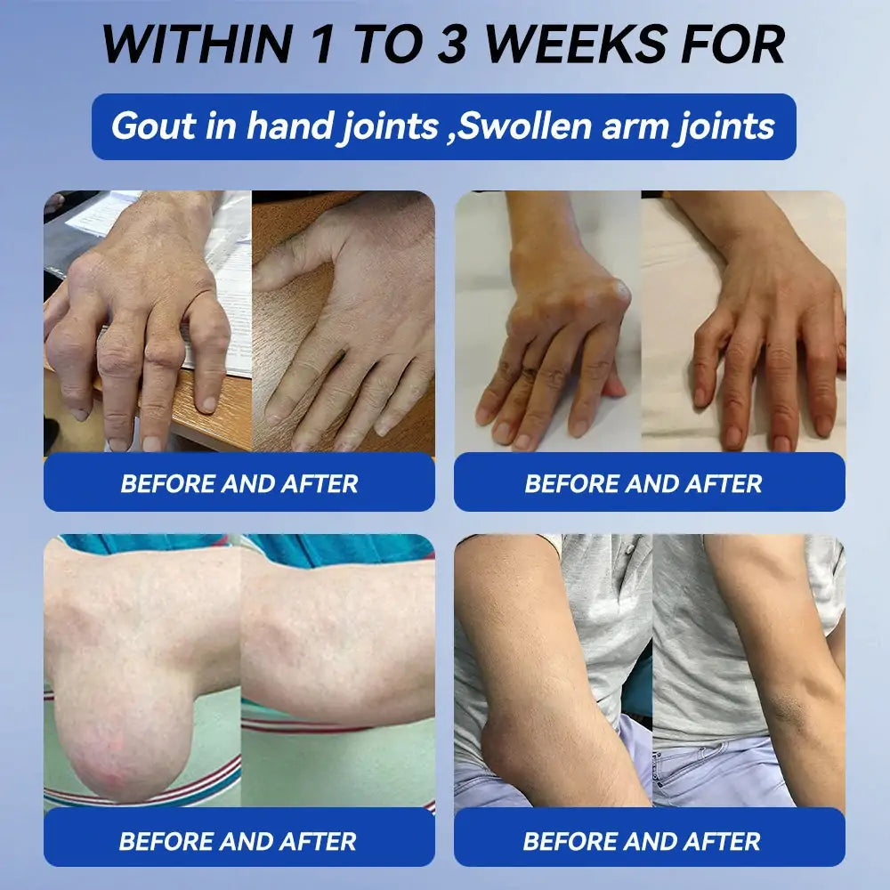 | 𝐋𝐚𝐬𝐭 𝐃𝐚𝐲 𝐏𝐫𝐨𝐦𝐨𝐭𝐢𝐨𝐧 𝟖𝟎% 𝐎𝐅𝐅🇬🇧 𝐂𝐫𝐨𝐚𝐢𝐞® 𝐁𝐏𝐂-𝟏𝟓𝟕 𝐉𝐨𝐢𝐧𝐭 𝐇𝐞𝐚𝐥𝐢𝐧𝐠 𝐂𝐫𝐞𝐚𝐦 - 🦴(Treats Arthritis, Neuropathy, Rheumatism, Sports Injuries & More)🏆