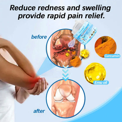Tnnedey® Arthritis Soothing Pain Relief Massage Gel (Contains Turmeric and Emu Oil)👨‍⚕️BOA accreditation