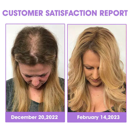 DEEVOO® ✨👩‍🔬 Hair Root Repair Growth Drops – Achieve Thicker Hair Fast⚡
